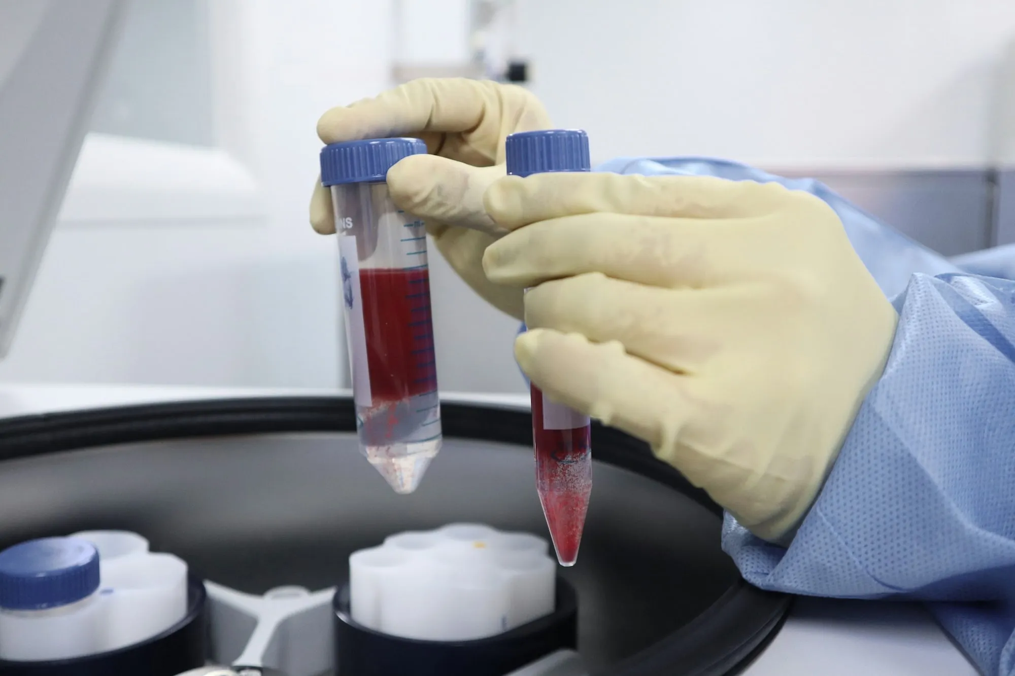 Tubos con el plasma separado tras la centrifugación